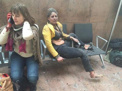 Τραυματίας στο αεροδρόμιο των Βρυξελλών λίγο μετά την τρομοκρατική επίθεση της 22ας Μαρτίου 2016.